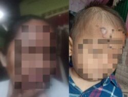 Miris, Anak SMP di Balikpapan Siram Air Panas ke Ibu dan Balita
